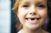 Нужно ли лечить молочные зубы? 