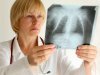 Какие симптомы могут указывать на туберкулез легких?