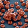 Как повысить гемоглобин в крови?