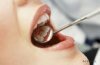 Каковы противопоказания при отбеливании зубов?
