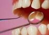 Можно ли из стволовых клеток вырастить зубы?