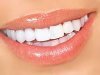 Как безопасно отбелить зубы? 